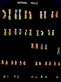 Male karyotype