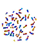 Normal female karyotype