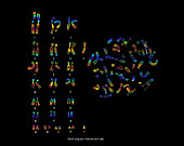 Testicular Feminization Karyotype