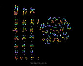 Testicular Feminization Karyotype