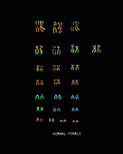 Normal Female Karyotype