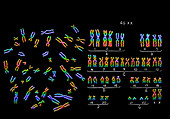 Normal Female Karyotype