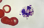 Staphylococcus in White Blood Cell