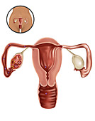 Ovulation