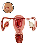 Ovulation