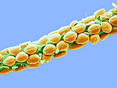 Epiphytic Diatoms,SEM