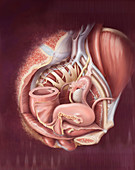 Posterior Compartment Prolapse