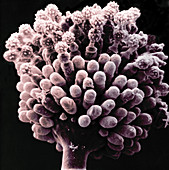 Aspergillus niger Conidiophores (SEM)