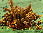 Rose Rust (SEM)