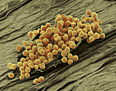 Cereal Rust (SEM)