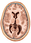 Transverse Section of the Brain