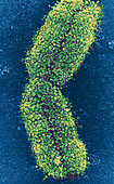 Chromosome from Lymphocyte,SEM