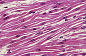 Smooth Muscle (LM)