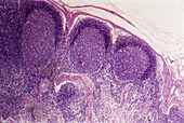 Lymph Node Cortex (LM)