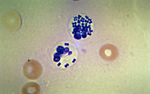 Phagocytosis (LM)