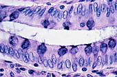 Secretory Epithelium with Goblet Cells
