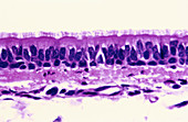 Ciliated Columnar Epithelium (LM)
