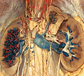 Kidney and Suprarenal Gland