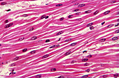 Smooth muscle,light micrograph