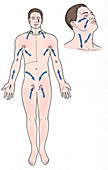 Direction of Lymph Flow