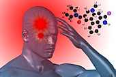 Cluster headache