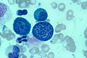 Blood Cells in Prophase,LM