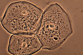 Epithelial Cells from Human Cheek,LM