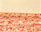Transitional Epithelium (Stretched),LM