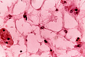 Reticulum Cells in Bone Marrow,LM