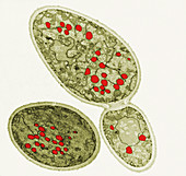 TEM of Saccharomyces Cerevisiae