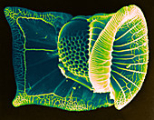 Ornithocercus Dinoflagellate
