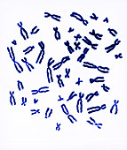 Male Karyotype