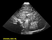 Neonatal Transcranial Ultrasound