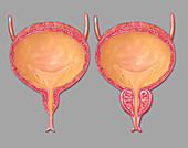 Full Bladders,Illustration