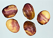 Purple stain (Cercospora kikuchii)