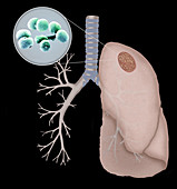 Streptococcus Pneumoniae,Illustration