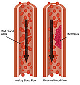 Blood Flow,Illustration