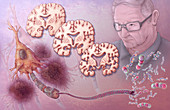 Alzheimer's Pathology,Illustration