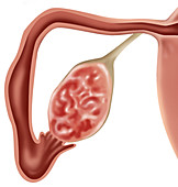 Fallopian Tube and Ovary,Illustration
