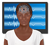 Biofeedback Therapy,Illustration