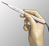 Cautery Knife,Illustration