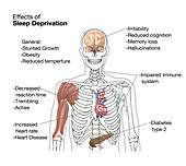 Sleep Deprivation Effects,Illustration