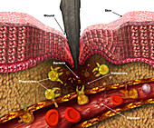 Inflammation Response,Illustration
