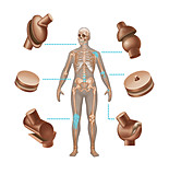 Human Joint Replacements,Illustration