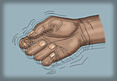 Hand Tremor,Illustration