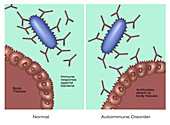 Autoimmune Disease,Illustration