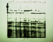 DNA Fingerprint Map