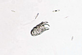Keratella cochlearis,a rotifer