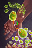 Staph infection,illustration