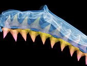 X-Ray of Shark Jaws